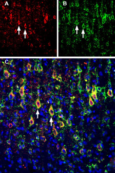 Guinea pig Anti-Kv2.1 Antibody